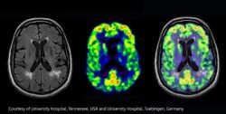 Photo: Worlds first human brain images scanned with a PET/MRI hybrid system