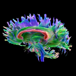 Fiber bundles of the brain – Cinematic Rendering based on data gleaned from...