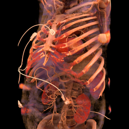 Skeleton with skull, ribs, sternum and pelvis. The heart is visible behind the...