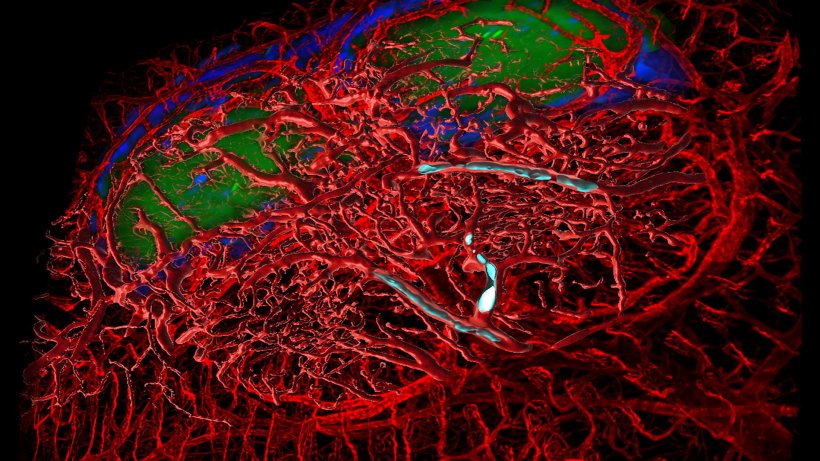 Fluorescence ultramicroscopy image of the special intestinal tissue of a mouse,...