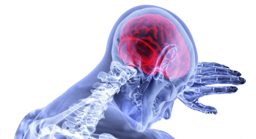 Stroke: largest-ever genetic study provides new insight