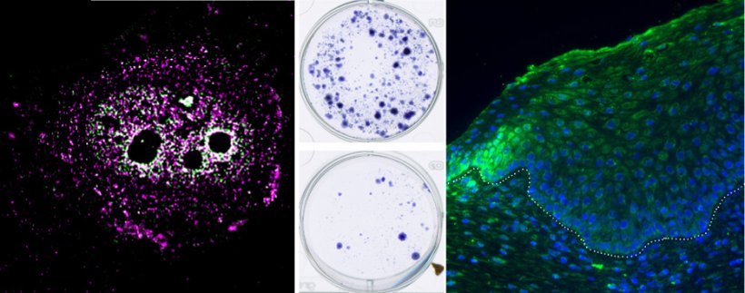 Von links: MYPOP-Lokalisation (magenta) in einer Hautzelle; Wachstum von...