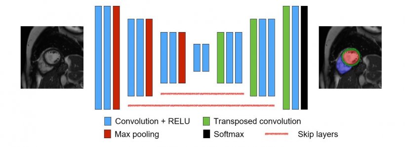Convolutional Neural Network for Image Segmentation: AI is a tool for the...