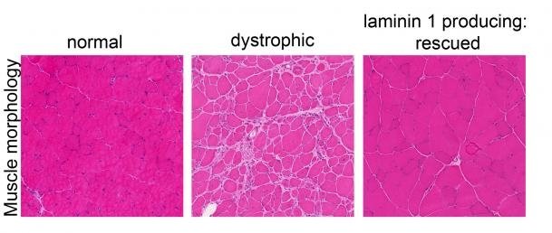 Muscle morphology in normal, dystrophic and rescued muscle tissue in mice