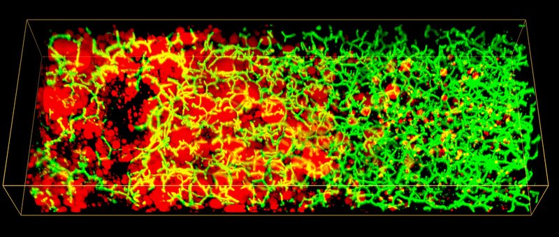 3D image of lipid droplets (red) and Bile Canaliculi network (green) along the...