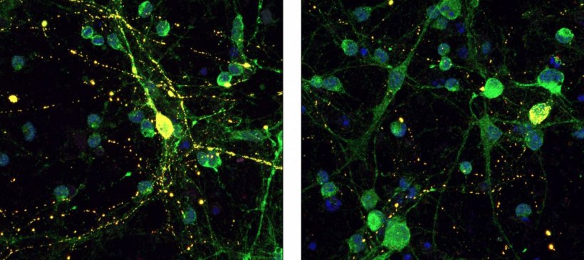 A peptide that stimulates receptors in neurons reduced the amount of toxic tau...