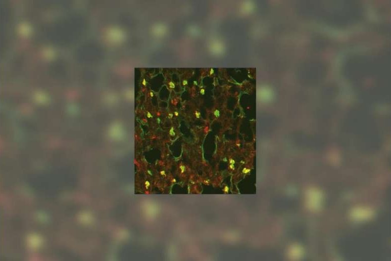 Immunfluoreszenzbild von Lungengewebe mit TRPML3 (grün) und Makrophagen (rot).