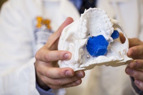 A 3-D model of a patient’s skull helped doctors prepare for surgery to remove...