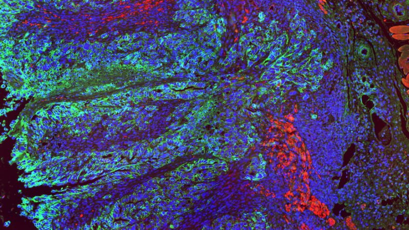 Ein mehrfarbiges Bild von Darmgewebe. Einzelne Zellkerne sind in Blau...