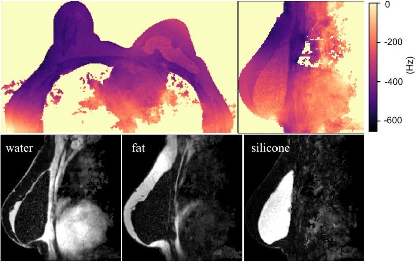 Field mapping results for imaging of water, fat and silicone