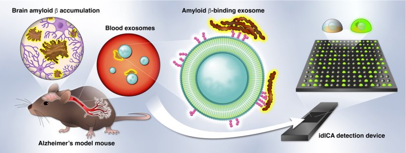 Concept for digital detection of amyloid β-binding exosomes in the blood of an...