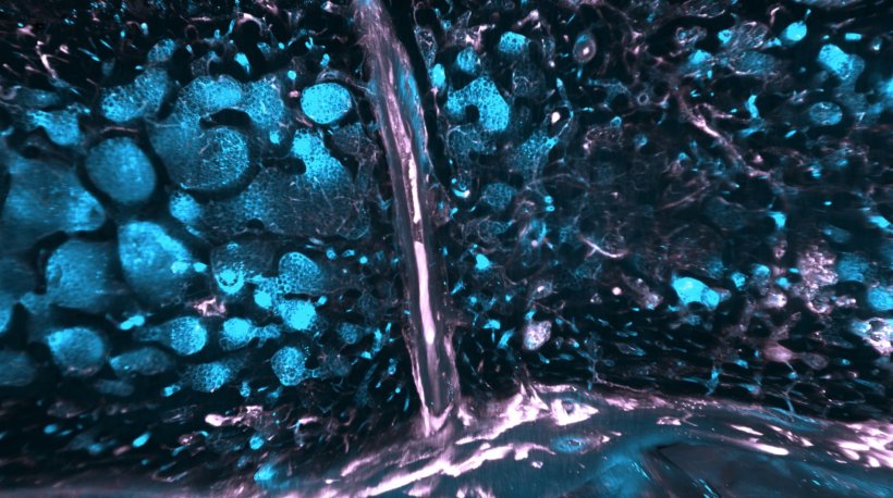 Immunzellen in blau und Gefäße in pink im Knochenmark des Schädels: Das Bild...