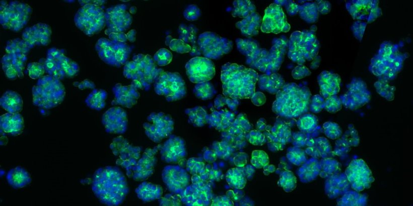 Tumor organoids (green/blue) are used as a model to study the metabolic changes...