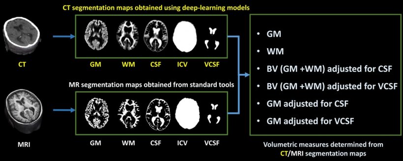 Imaging-based volumetric measures. The CT-based gray matter (GM), white matter...