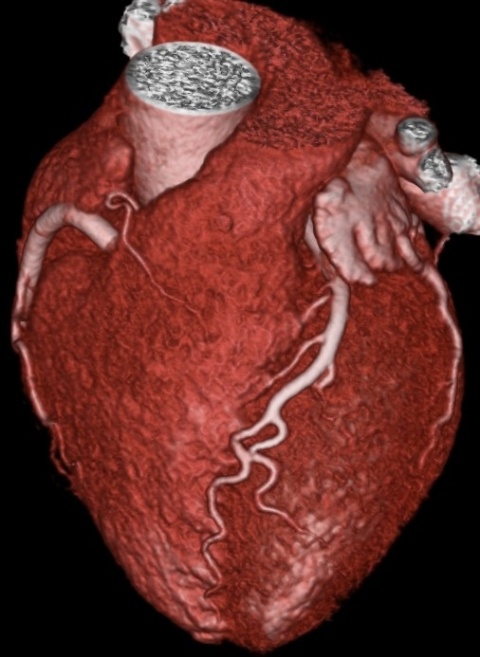 image of a heart.