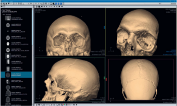 ITZ Medicom – ITZ Hyper.PACS – Reporting & advanced visualization