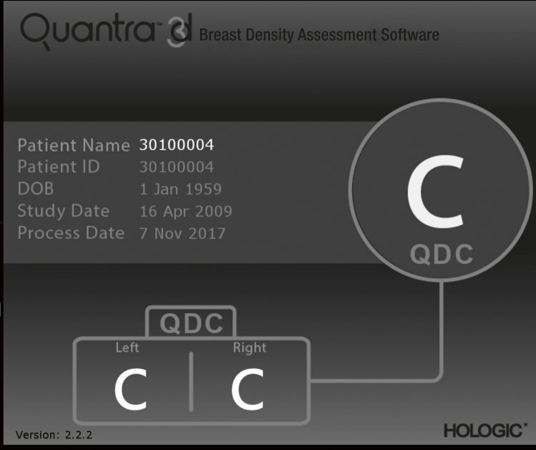 hologic horizon user manual