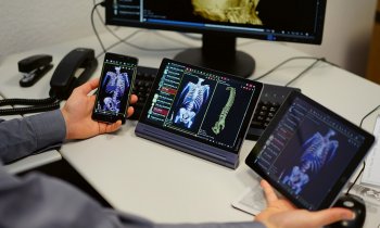ITZ Medicom – ITZ Hyper.mView - Mobile Solution