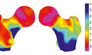DMS Imaging – 3D DXA