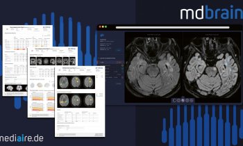 mediaire – mdbrain