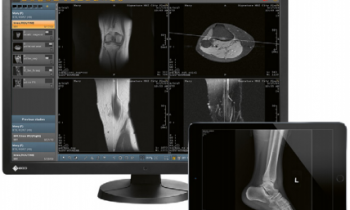 Del Medical · EvoView PACS
