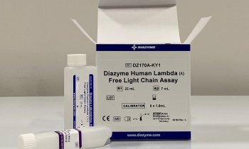 Diazyme Human Kappa & Lambda FLC assays