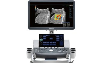 Mindray Medical · DC-80A with X-Insight