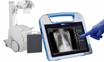 Roesys – X Vision go – Lightweight mobile DR Retrofit for ICU and RAD
