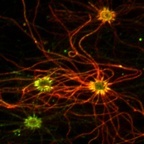Live olfactory sensory neurons, the cells responsible for detecting odors....