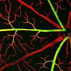 Blood vessels near the center of a healthy mouse retina. Arteries in green;...