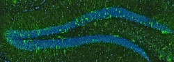 Neugeborene“ Nervenzellen (grün) im Gehirn einer drei Monate alten...