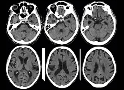 Photo: rfMRI reveals mind moving matter