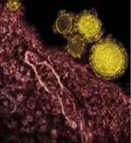 Dr Christian DrostenTransmission electron micrograph of novel coronavirus...
