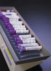 Photo: Advances in blood group serology