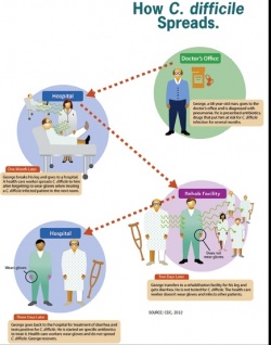 Photo: Clostridium difficile infection