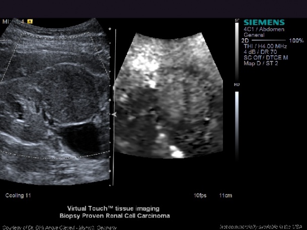 Photo: We have entered ultrasound’s renaissance period