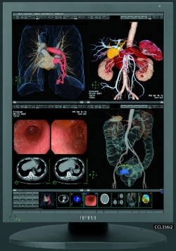 Photo: LED colour displays for diagnostic use