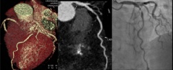 Photo: Should CTA become a screening procedure?