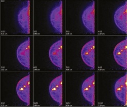 PEM produces a 12-slice tomographic image display