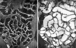 Photo: Small bowel imaging