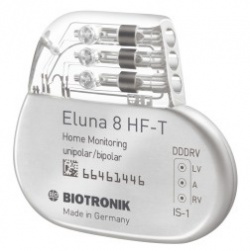 Photo: First pacemaker with event-triggered IEGM transmissions