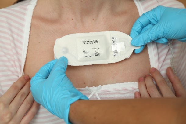 New disposable, wearable patch found to effec