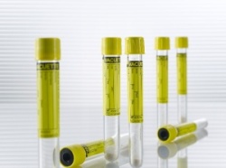 The VACUETTE® Urine CCM Tube is a new practical and satisfactory solution for...