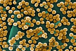 Staphylococcus aureus infection is a frequent cause of sepsis.
