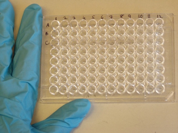 ELISA and nucleic acid tests enable early detection of Ebola virus. Foto:...
