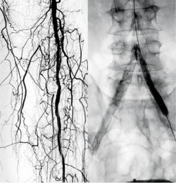 Mobile X-ray imaging is used for various interventions such as heart valve...