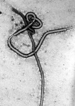 Das Ebolavirus besitzt eine fadenförmige Gestalt.