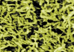 Clostridium difficile angereichert aus einer Stuhlprobe durch Filtration ©CDC