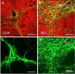 Rat model fibrosis study, with images taken from Carbon tetrachloride (CCl4)...