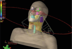 Treatment plan for 4D Radiation therapy